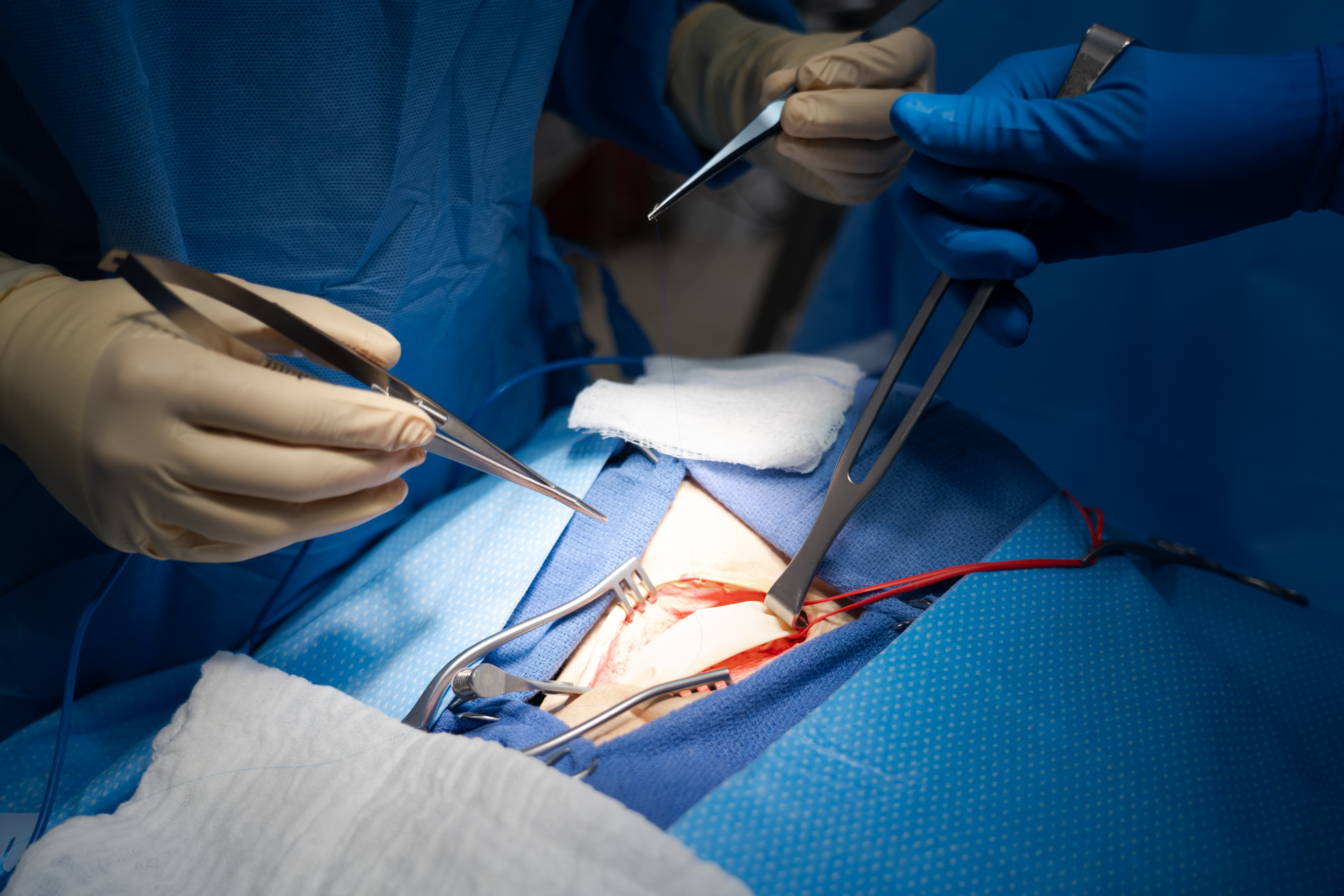 Student passing surgical equipment